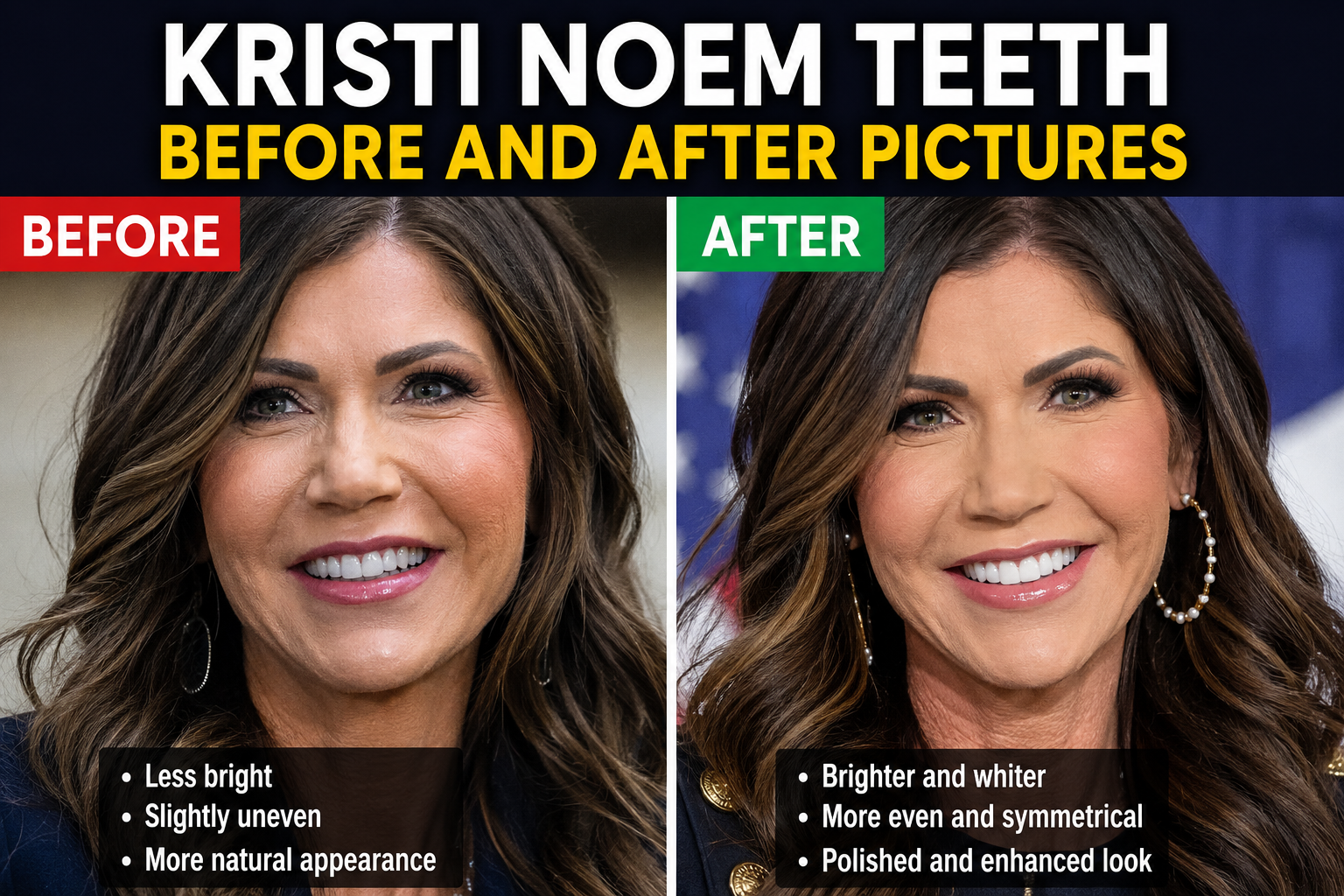 Kristi Noem Teeth Before and After Pictures: What People Notice and the Facts Behind the Change